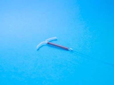 Integrated Application Of Catheter System hauv Laparoscopic Left Lateral Segm...
